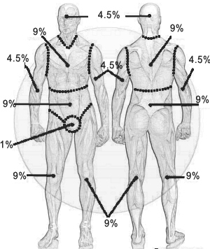 Pediatric Burn Percentage Chart